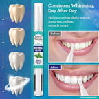 GuruNanda Teeth Whitening Pen 20 Gebruiken – 1,8 ml