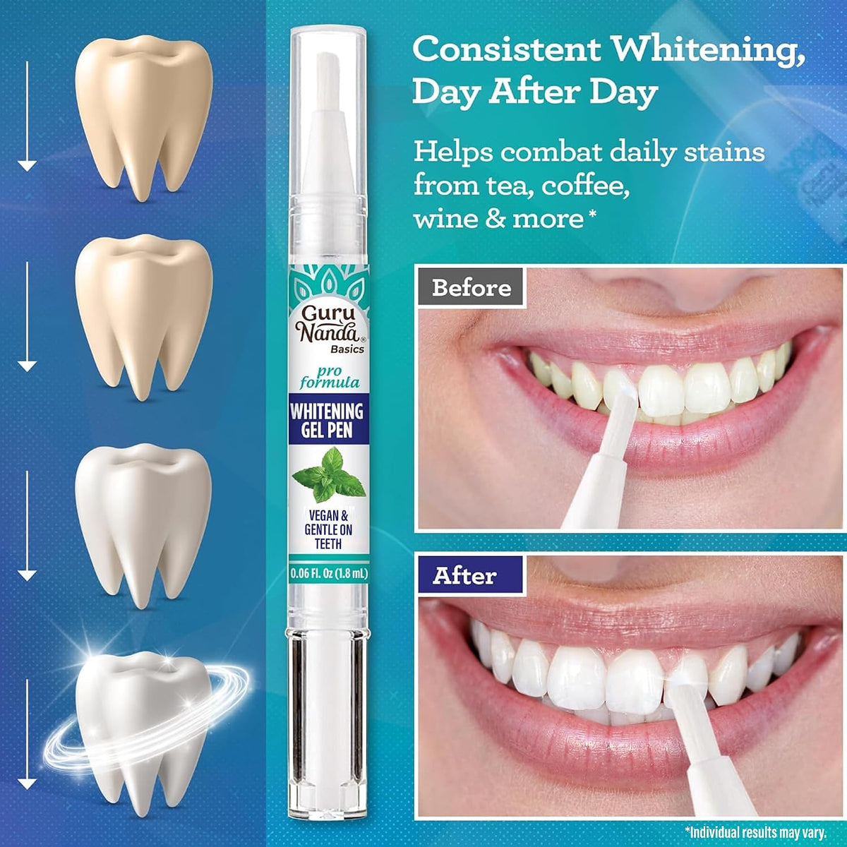 GuruNanda Teeth Whitening Pen 20 Gebruiken – 1,8 ml